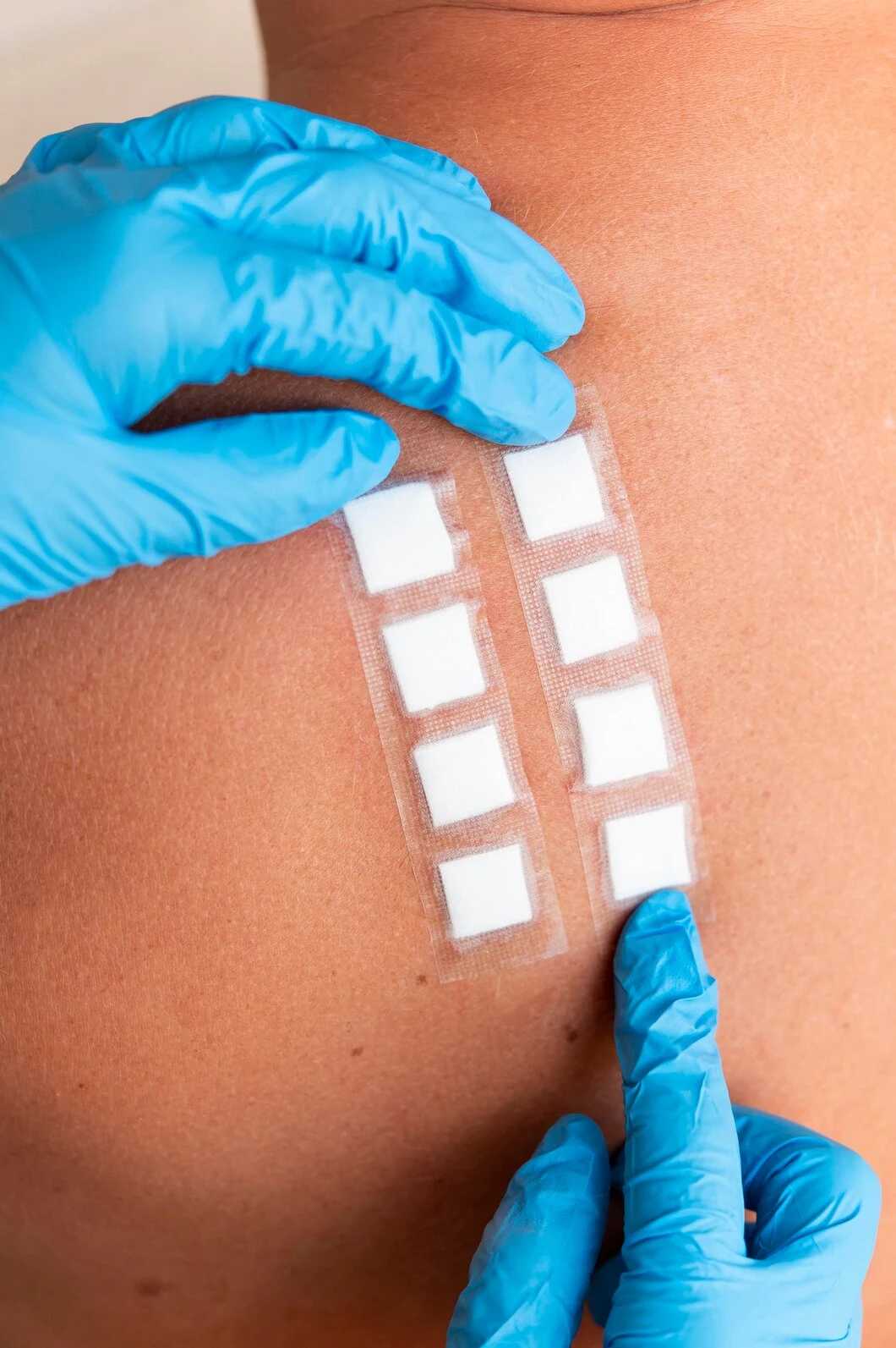 Atención profesional