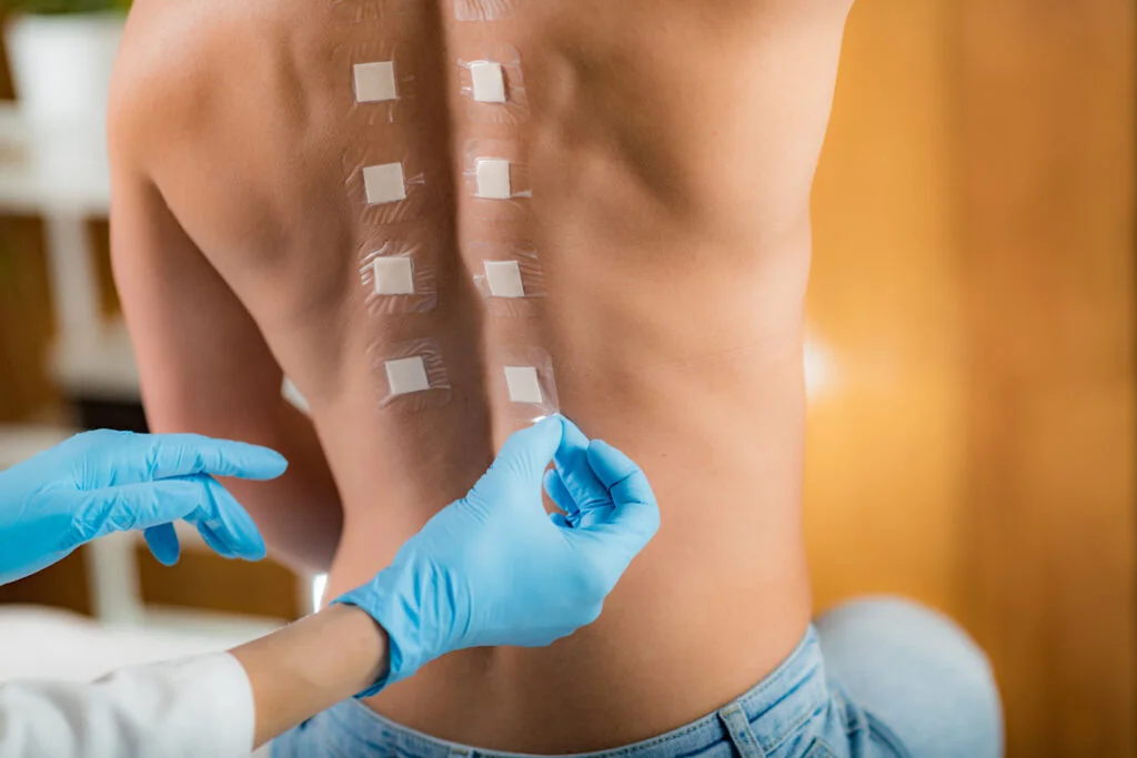 Pruebas epicutáneas de parche